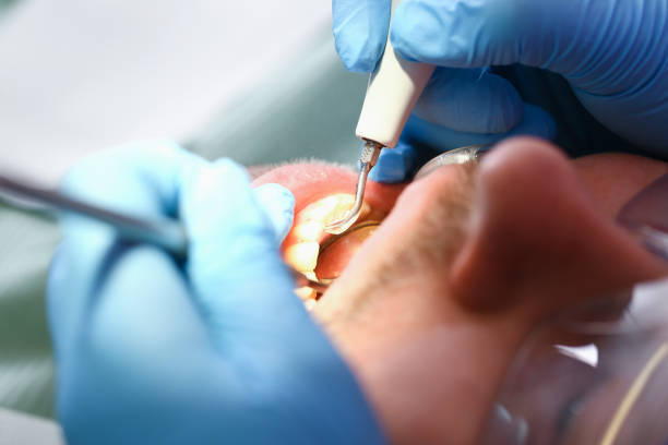 Best Broken or Cracked Tooth Emergency Dentist in Zillah, WA
